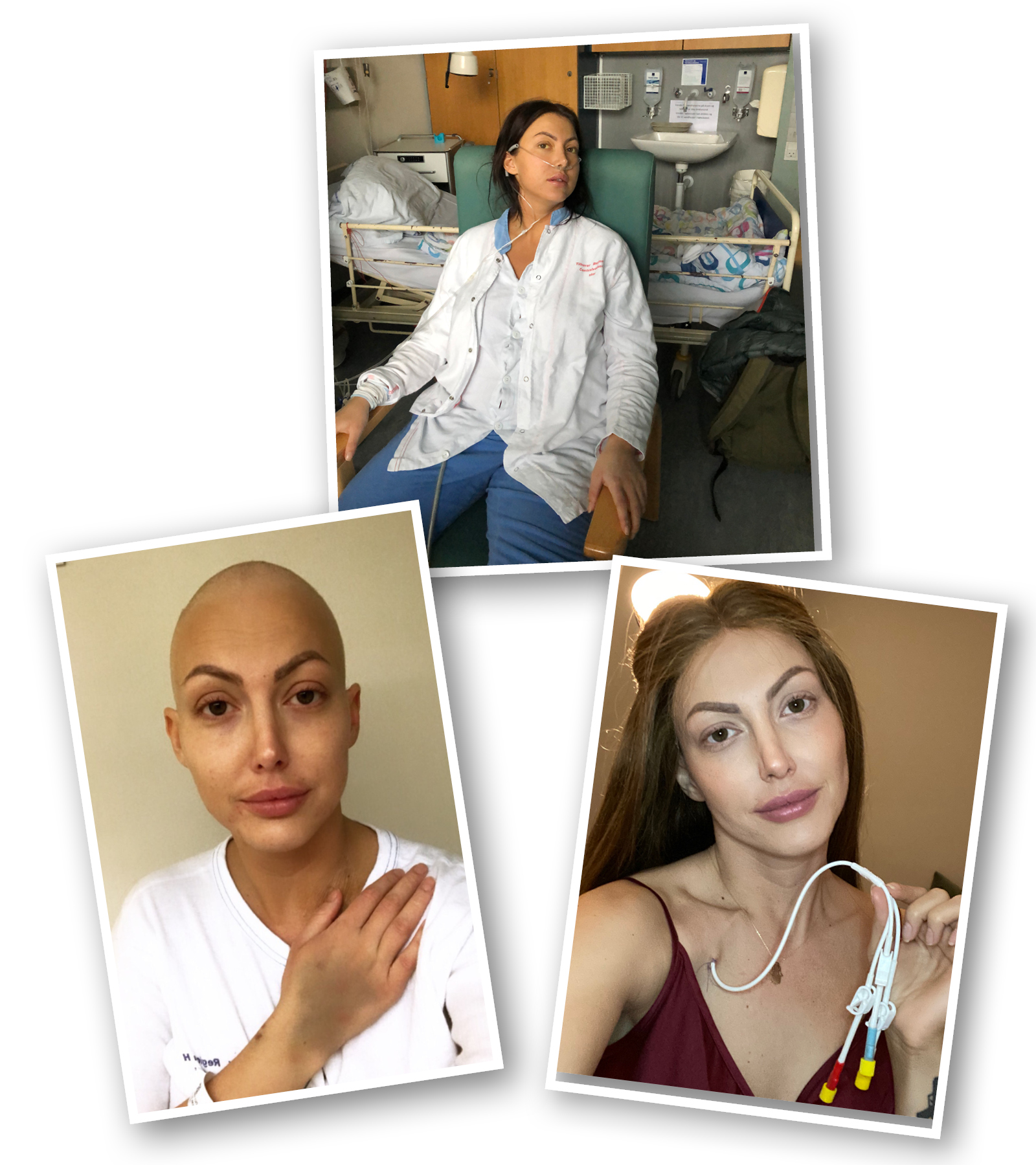 Tre billeder fra Michelles kræftforløb